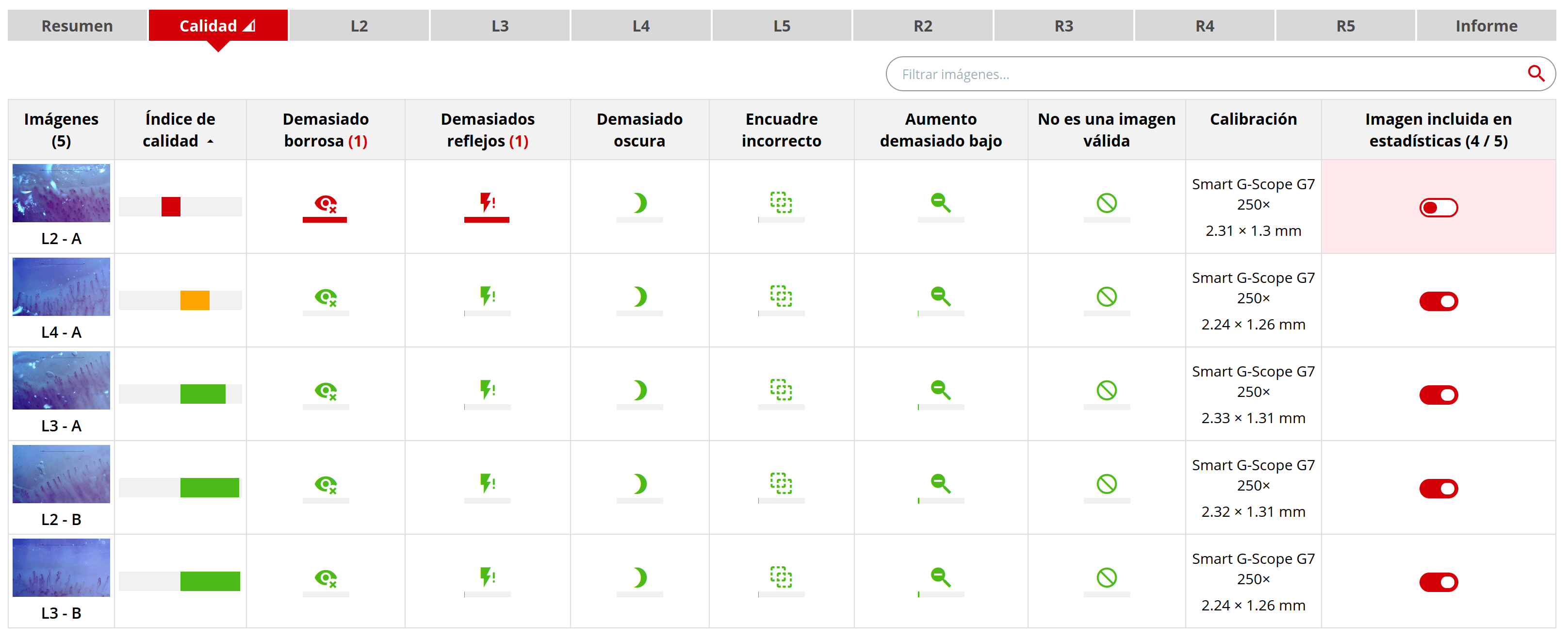 Evaluación automática de calidad de imagen en Capillary.io