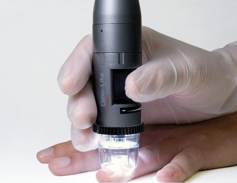 Dino-Lite CapillaryScope 200 Pro para capilaroscopia