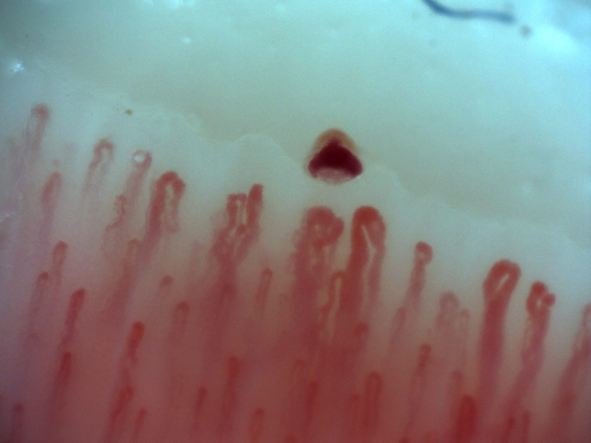 Detalle de capilaroscopia con Inspectis