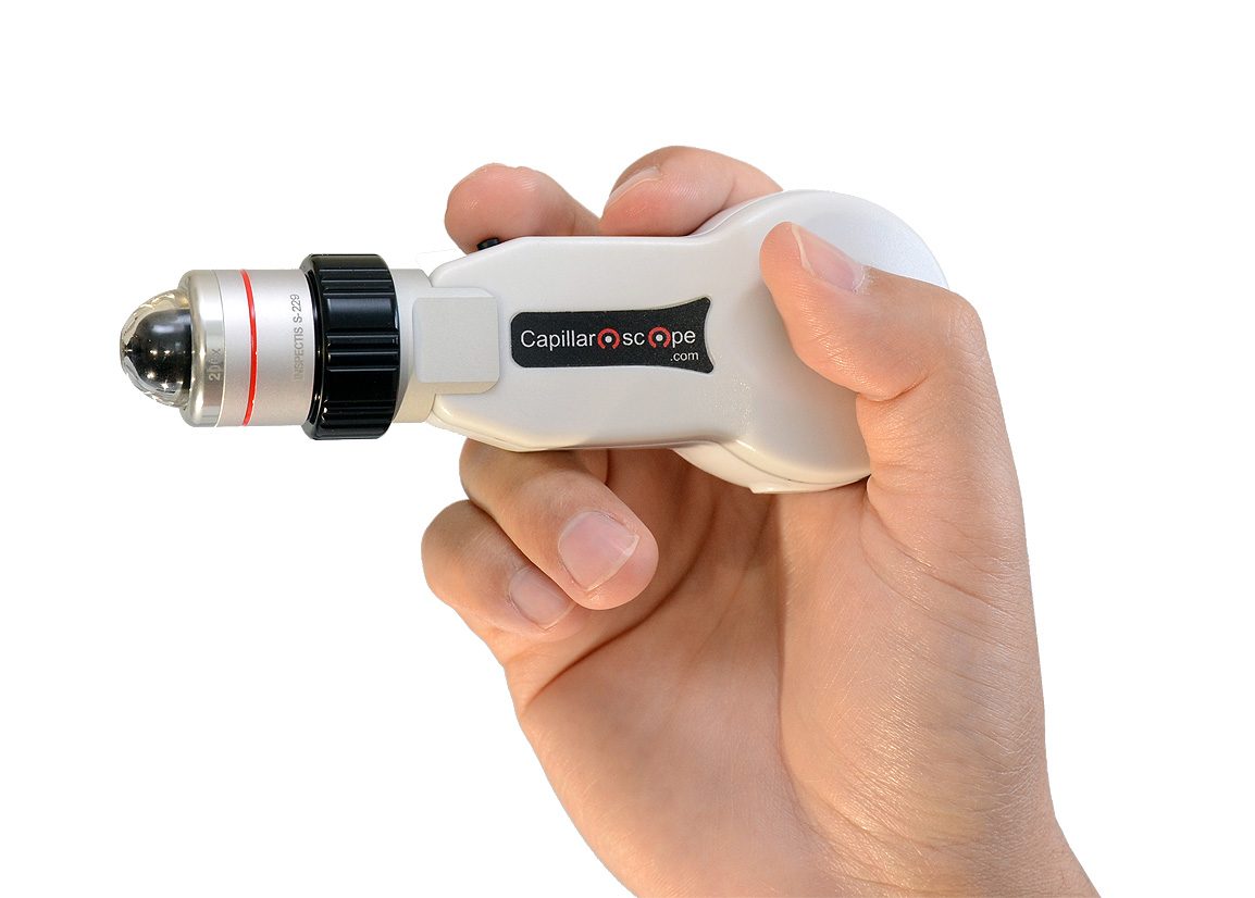 Inspectis Capillaroscope para lecho periungueal